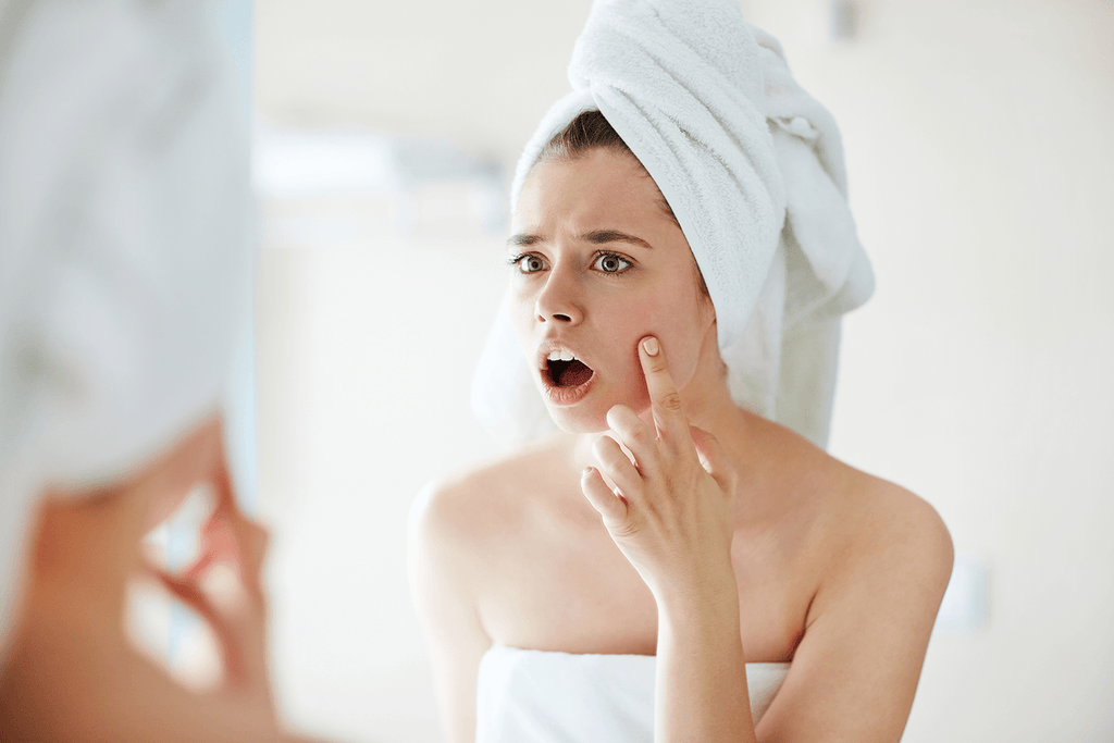 ACNE AND CBD OIL